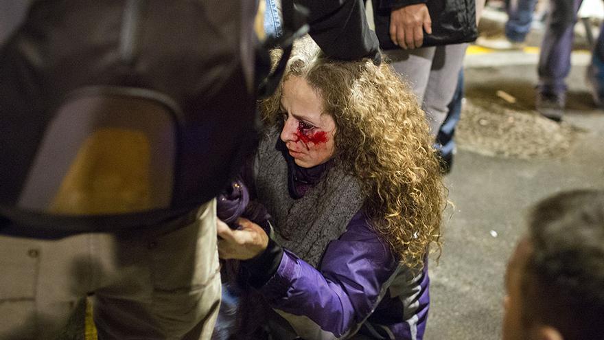 Una mujer pierde la vista de un ojo por el impacto de un disparo con bola de goma en la plaza de Catalunya durante la manifestación de la huelga. / Edu Bayer