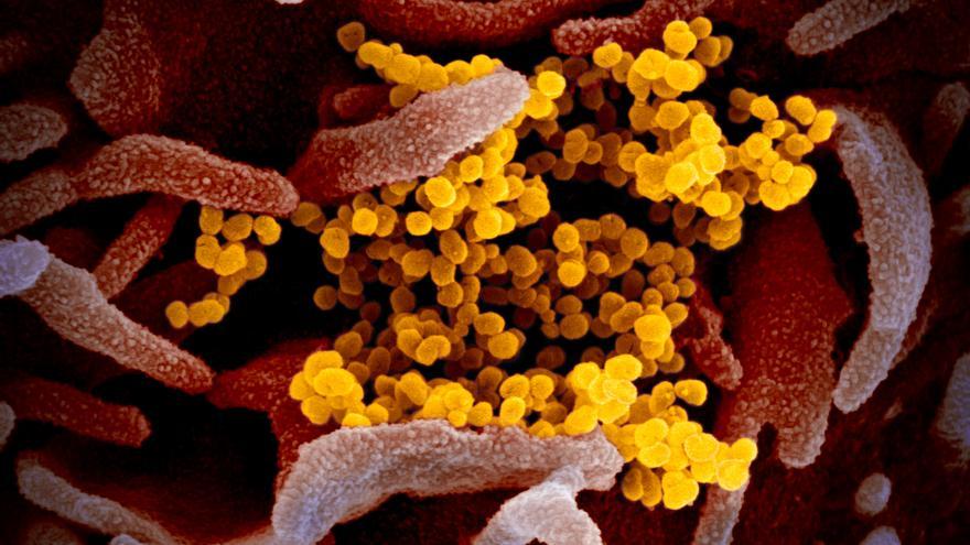 Imagen de microscopio electrónico de barrido que muestra SARS-CoV-2 (amarillo)