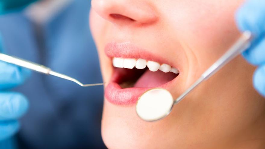 ¿Merece la pena pagar un seguro dental?