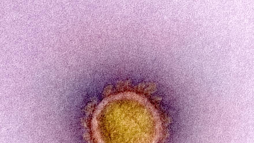  Micrografía electrónica de transmisión de una partícula de virus SARS-CoV-2