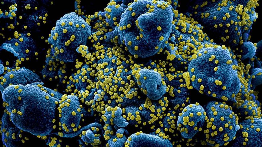 Partículas del virus SARS-COV-2 (en amarillo) infectando células (azuladas) aisladas de un paciente y vistas a través del microscopio electrónico de barrido con corrección de color. / NIAID