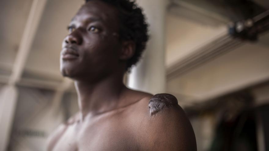 Tagnabou Elvis, rescatado por el Open Arms, relata las torturas sufridas en Libia.