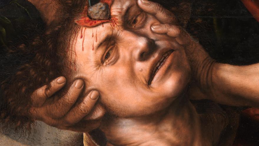 'El cirujano o La extracción de la piedra de la locura' (1550 - 1555)