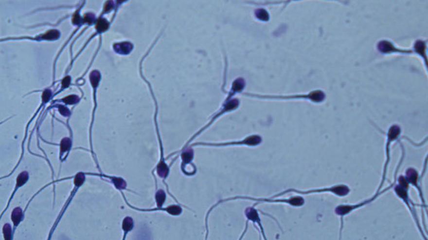 La concentración de espermatozoides en los hombres occidentales se está reduciendo