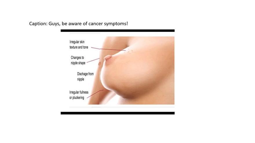 Una imagen advirtiendo de los síntomas del cáncer de mama
